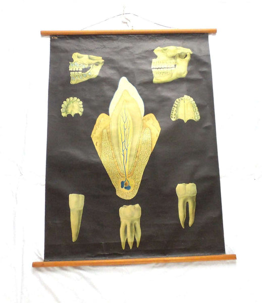 UpperDutch:School Chart,School Chart Teeth Vintage Dental Pull Down Chart. Dental practice decoration, wall decor for dentist office. Tooth wall art.